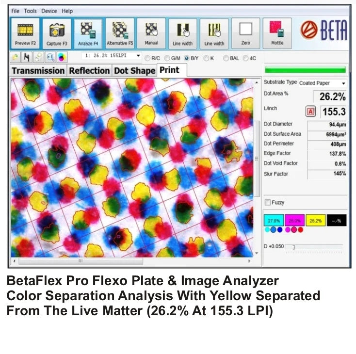 The NEW BetaFlex Pro2 Plate Image & Print Analyzer - The Best Just Got Better