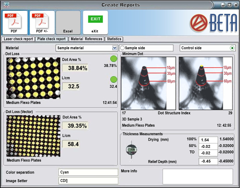 BetaFlex Pro FlexoEyePlus Database Software with WorkFlow Automation