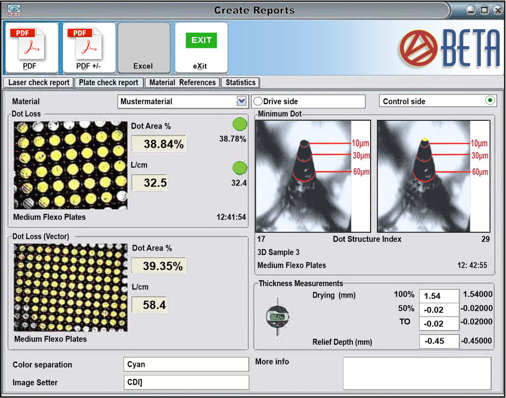 BetaFlex Pro FlexoEyePlus Database Software with WorkFlow Automation